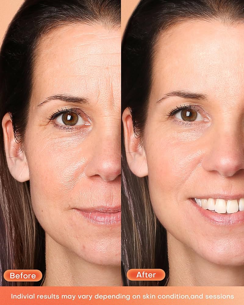Before and after comparison of a woman's face with visible skin improvement.